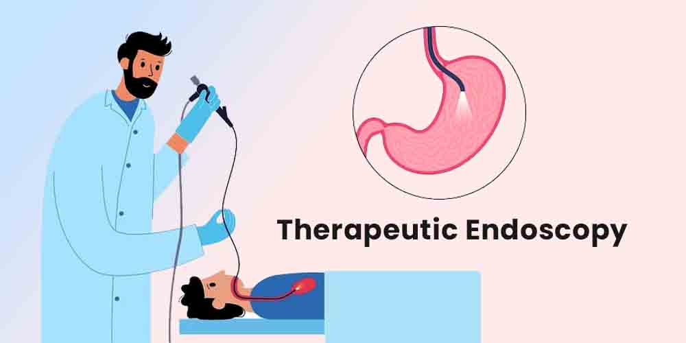 therapeutic endoscopy